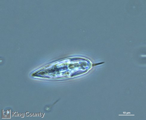 Photo of Prorocentrum gracile